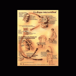 Poster plastifié N° 3 : Le disque intervertébral